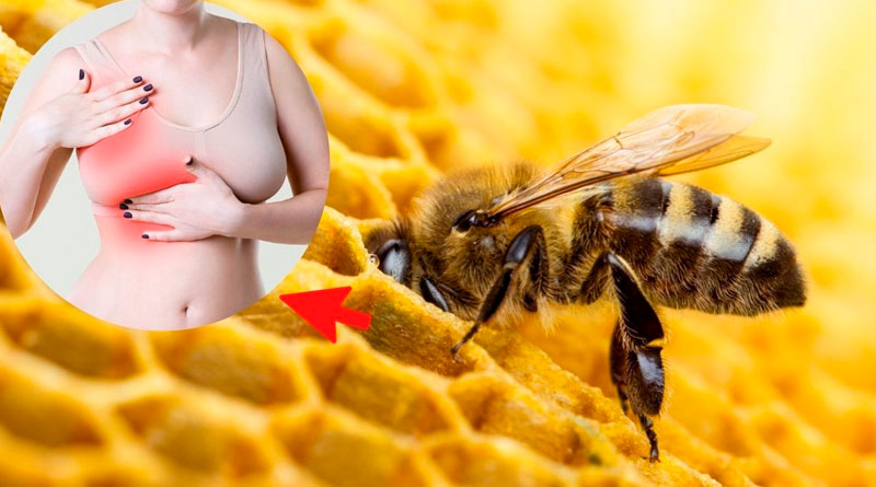 El veneno de las abejas puede destruir las células del cáncer de mama – El  Independiente