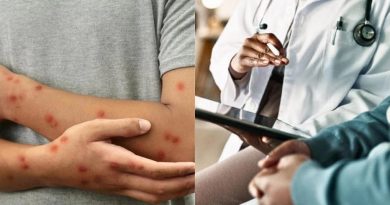 Alerta sanitaria en América por aumento del sarampión.